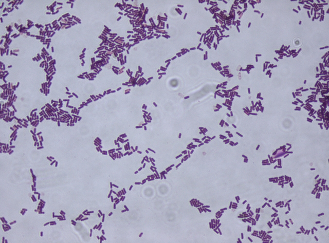 Un tipo di Bacillus osservato al microscopio - immagine Wikispecies