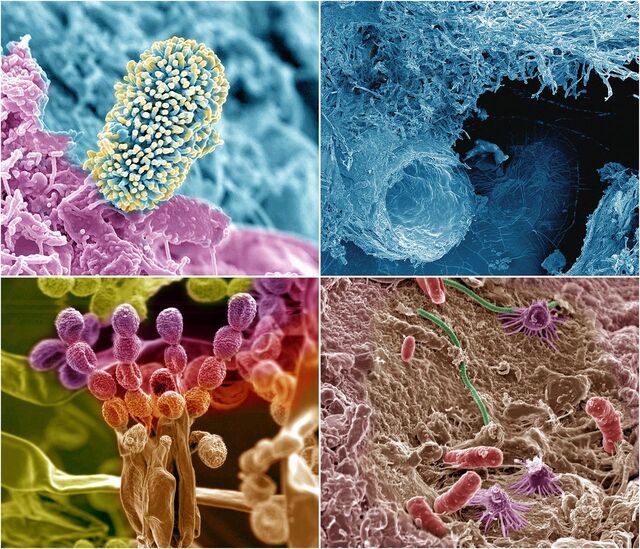 Durante e dopo il trattamento delle zone che furono di terre rare in Cina c'è un forte incremento di biodiversità microbica nel suolo - immagine PNAS