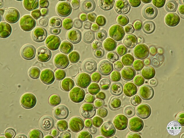 La Clorella vulgaris al microscopio - immagine The CAUP Database